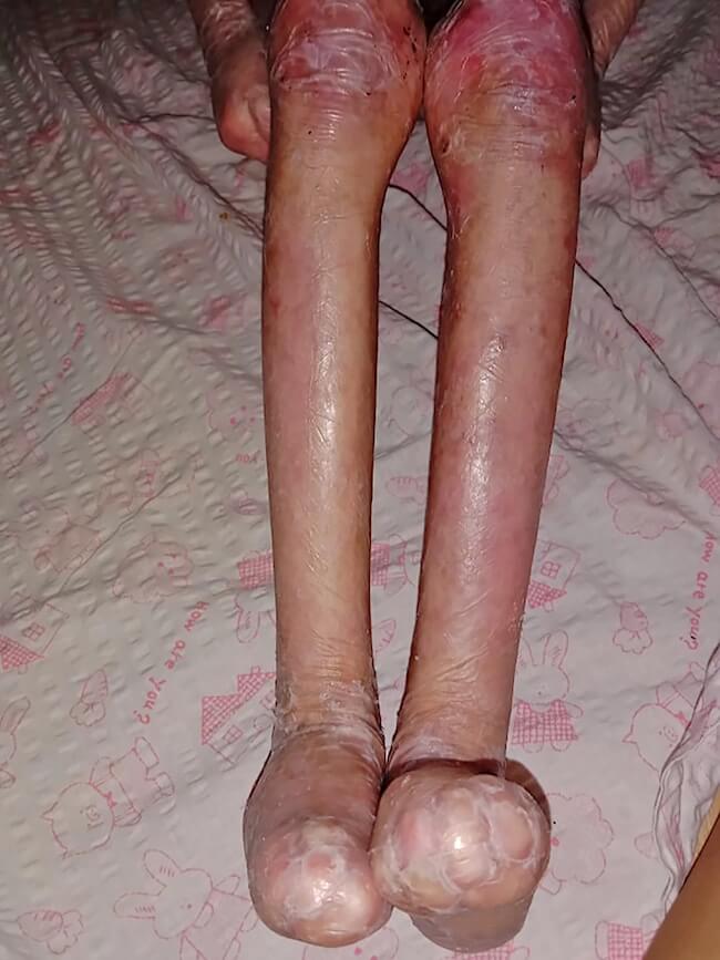 Shamila